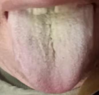 元气不固易体虚，调补心肾，筑牢身体根本






有不少男同胞，过往常年纵欲，