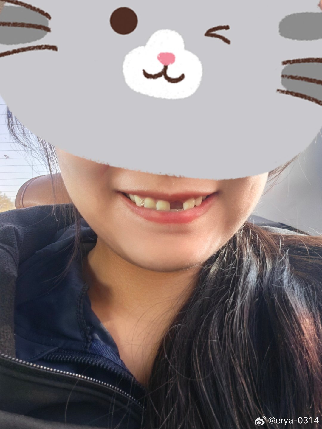 变成没牙佬了，不能在小地方做牙！ ​​​