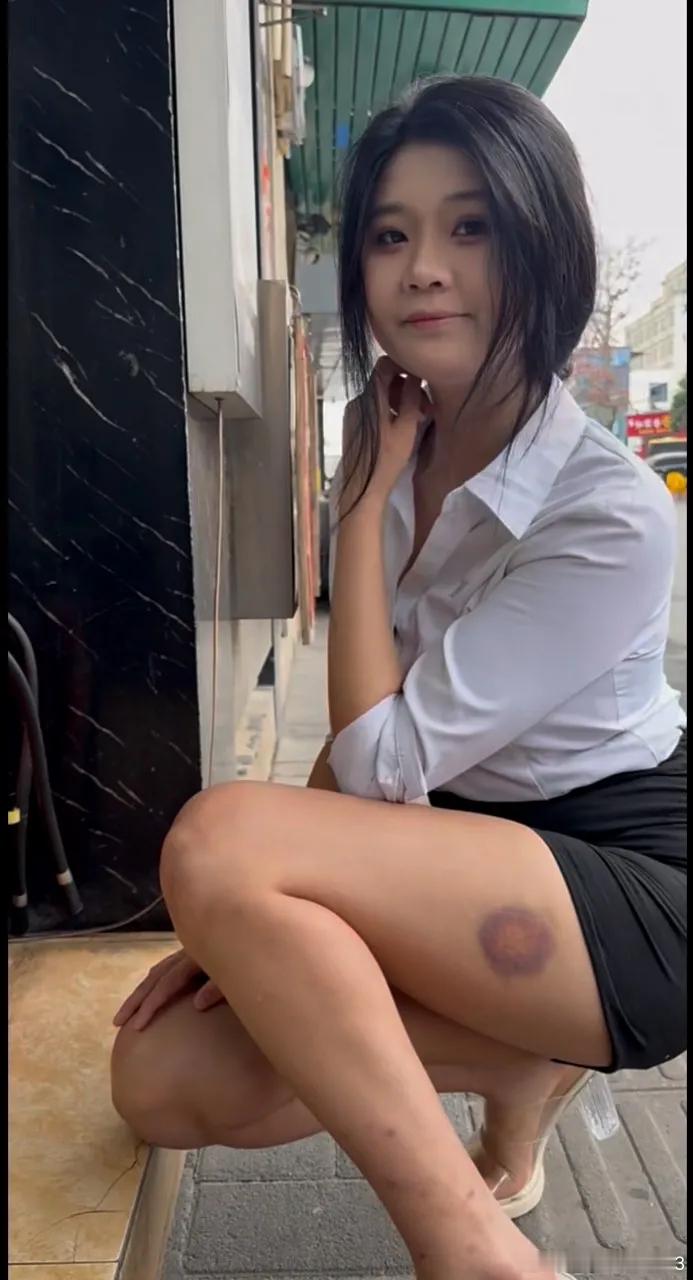 随手拍腿上怎么了 