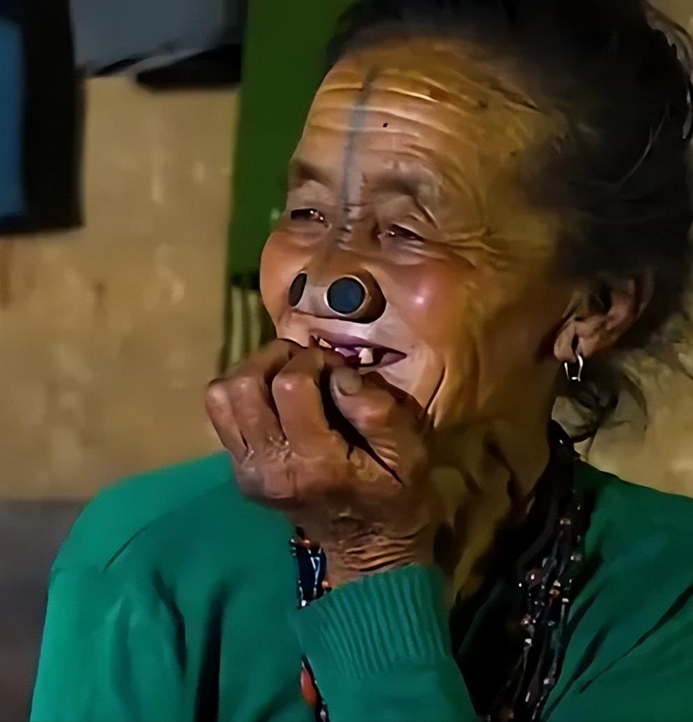 这是一个原始部落地区，这里的女人想要结婚，就要割掉鼻子的顶端，送给丈夫。切掉的鼻