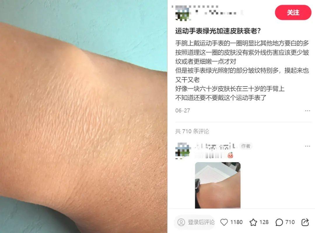 不少网友24小时佩戴运动手环，手腕出现一圈发白、粗糙、发痒起皮的情况。辟谣：网传