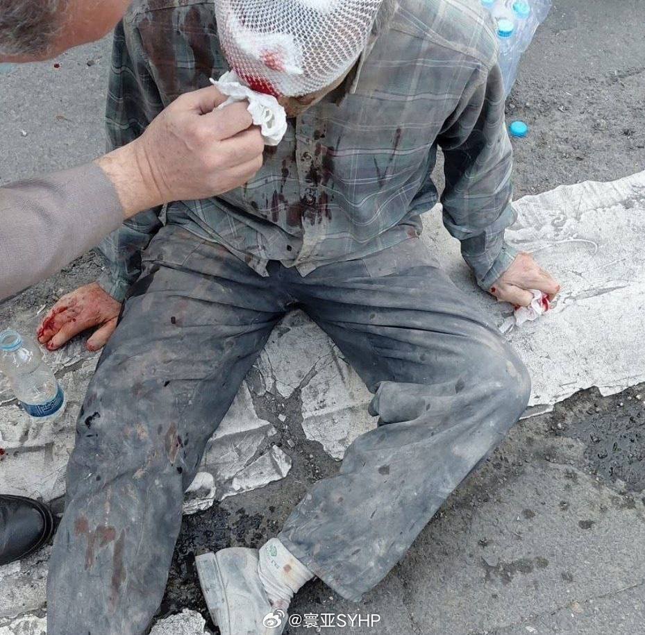 以色列宣布袭击伊朗遭到袭击的伊朗受伤者 