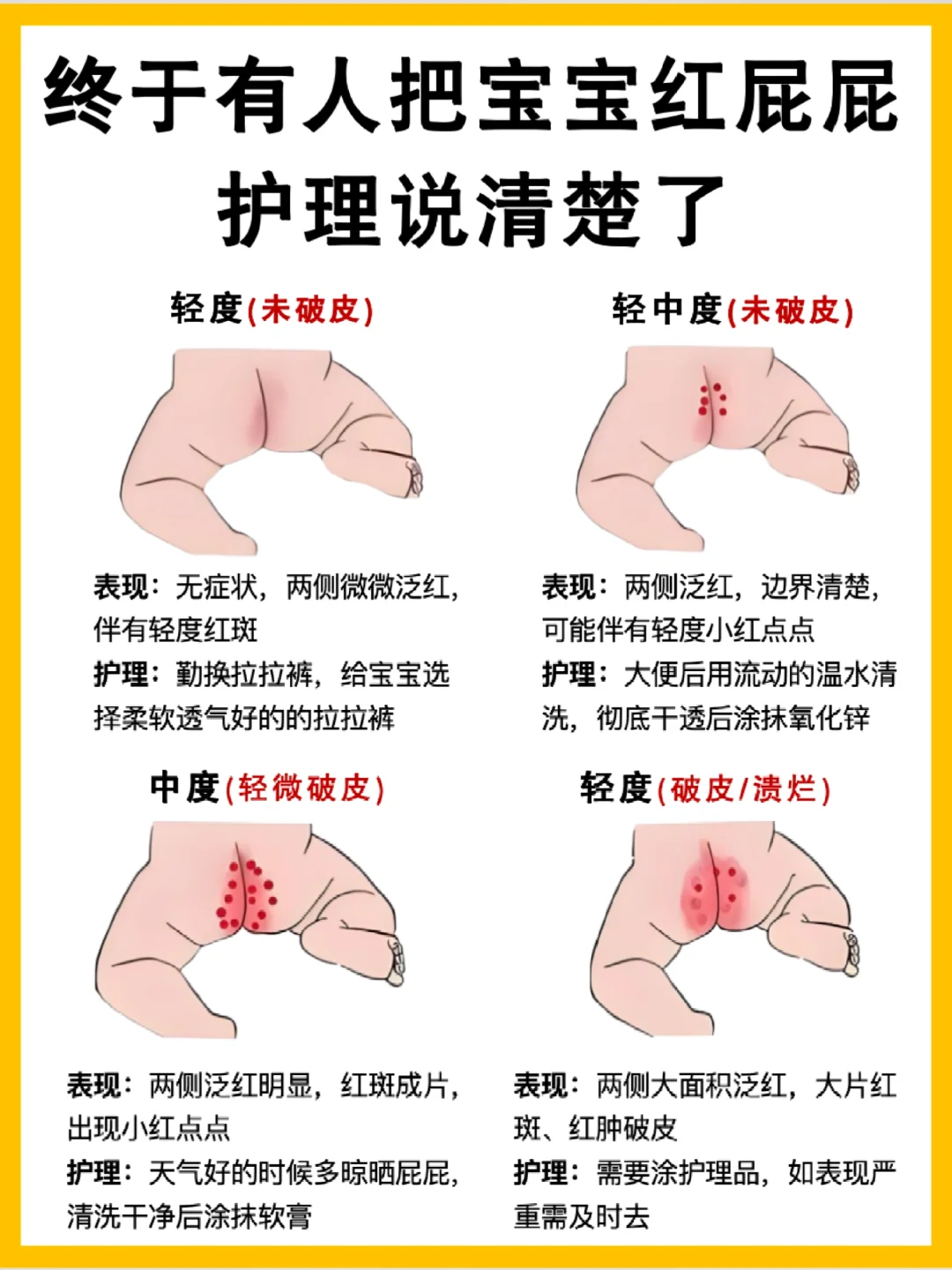 红屁屁别慌！一篇讲清楚退红全攻略
