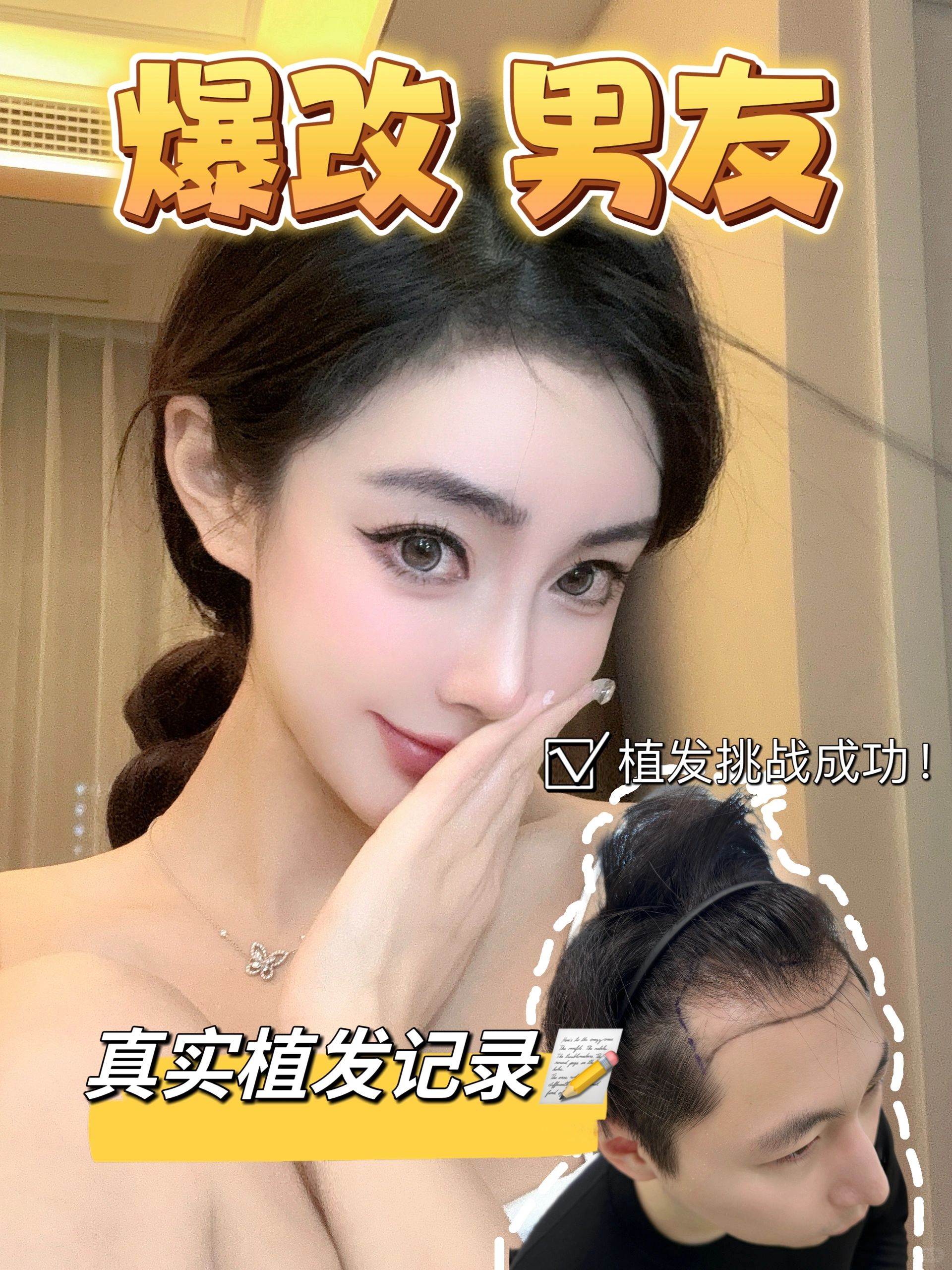 爆改男友之 植发篇