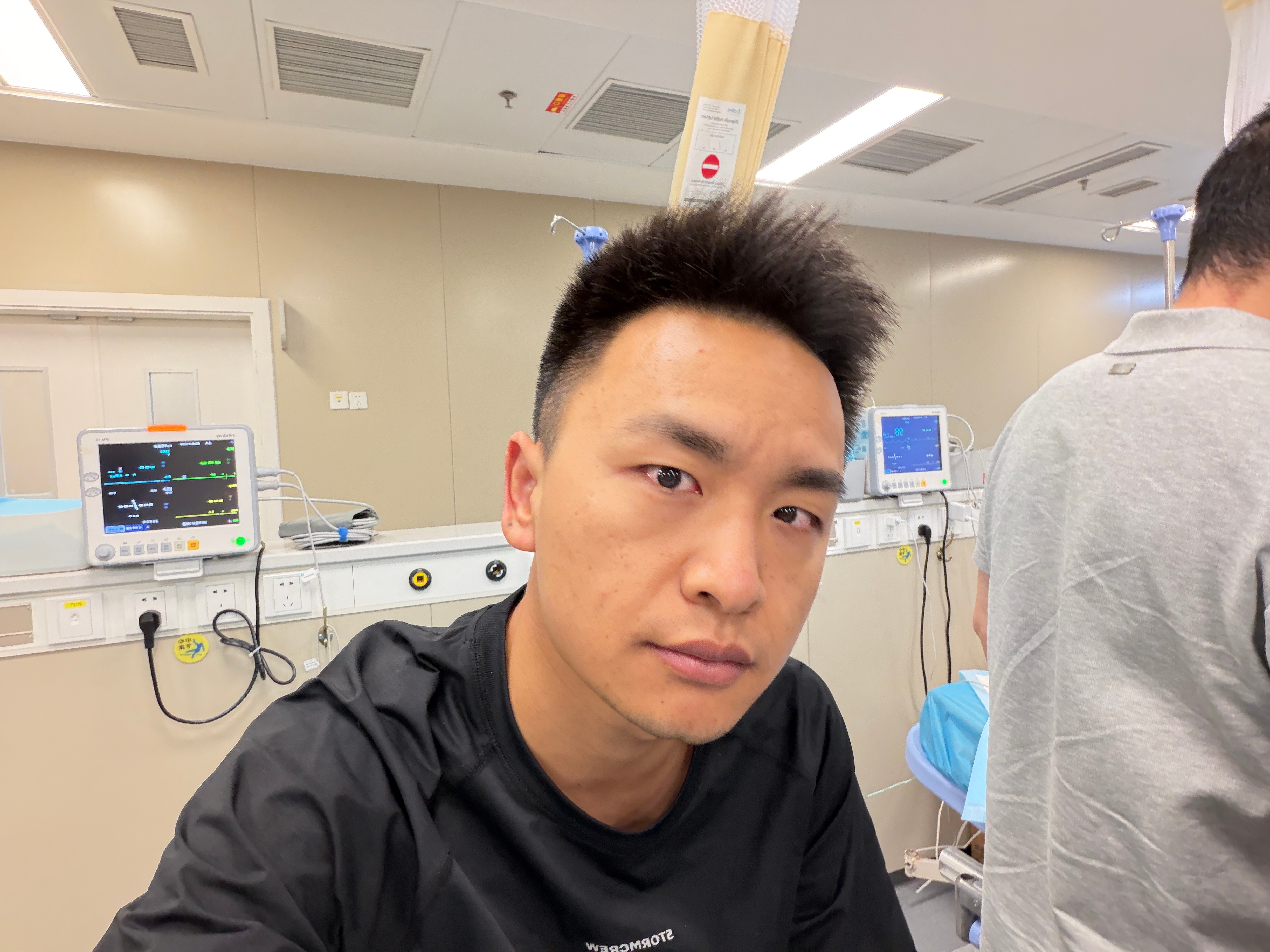 麻烦刚醒，等会给大家上 37 岁创业脑袋，作息不规律、饮食不规律的肠镜报告。