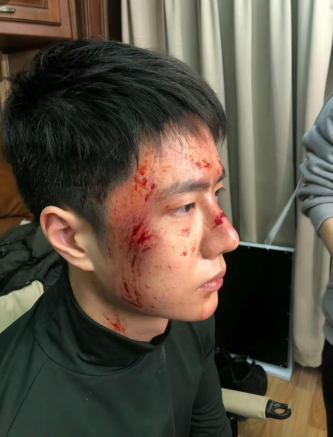 你勇敢的去闯去面对生活 不惧一切 你的勇气鼓舞了我们前进 你积极生活的这份态度也