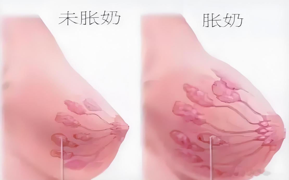 问：不涨奶，是不是回奶了?答：这是误解！红色部分是乳腺泡，奶在乳腺泡周围的泌乳细