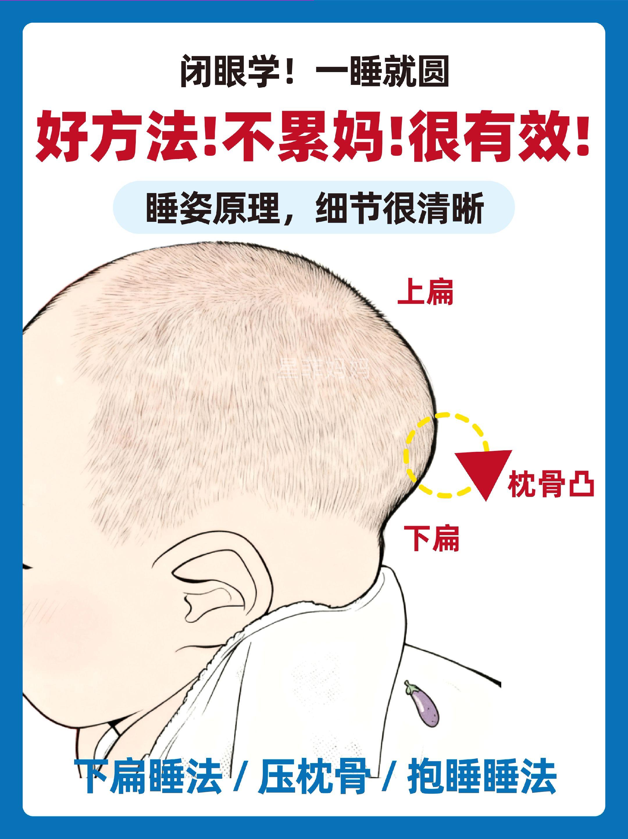 枕骨凸出+上扁睡圆头的方法。