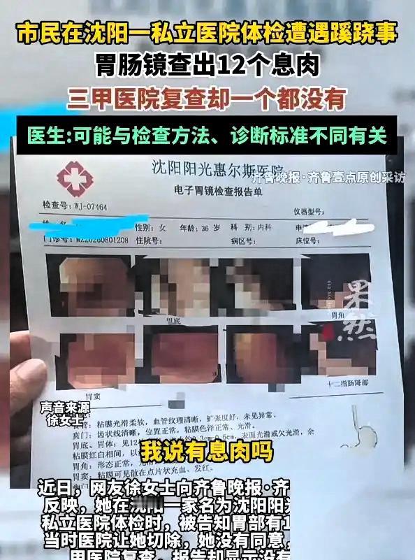 在辽宁沈阳发生了一件匪夷所思的事情，一女子陪着丈夫去体检，顺便做了一个胃肠镜检查