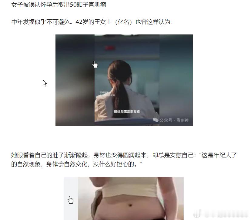 女子被误认怀孕后取出50颗子宫肌瘤如果您的子宫肌瘤较小，不引起任何不适，不影响怀