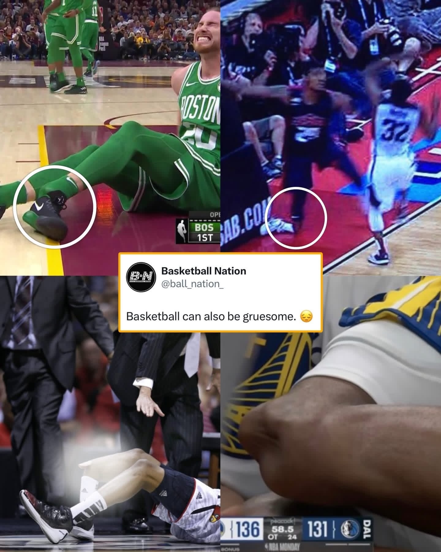 篮球运动非常残酷，令人震惊的、足以改变职业生涯的伤病会让球员和球迷都感到震惊。勇