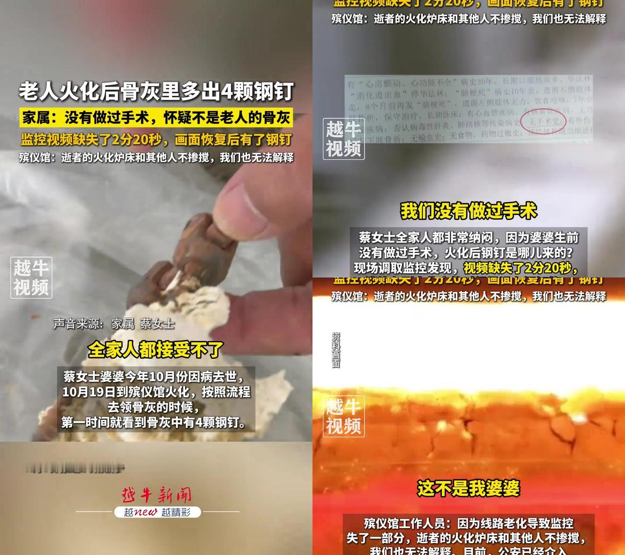 老人没开过刀，骨灰里居然有4颗钢钉？监控还断了最关键的2分钟，这事比吃了苍蝇还堵