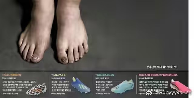 孙兴慜脚部严重扭曲变形 吓死我了，我以为受伤了呢，咱下回换双鞋不行吗。。。。