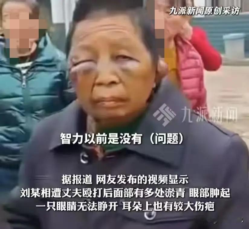 湖南被打老人丈夫75岁，已经被抓，据说有一儿一女，女儿已嫁，儿子外出打工。
 