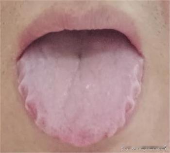 浑身乏力，消化不良，你吃健胃消食片就有用了？[捂脸][捂脸]

前天这个姐妹发来