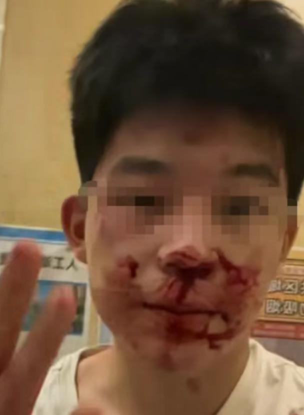 冒充民警打人者拘12天，借高考名义提前释放，22万买受害者闭嘴！
 
打人的王某