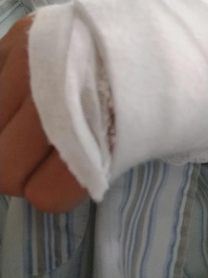 这次骑车摔倒骨折，可把我折腾得够呛，也让我深刻记住了两个教训。
首先，骑车切不可