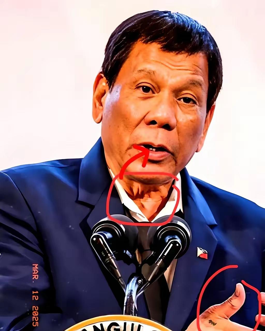 2026年1月26日，国际刑事法院正式裁定，80岁的菲律宾前总统杜特尔特身体状况