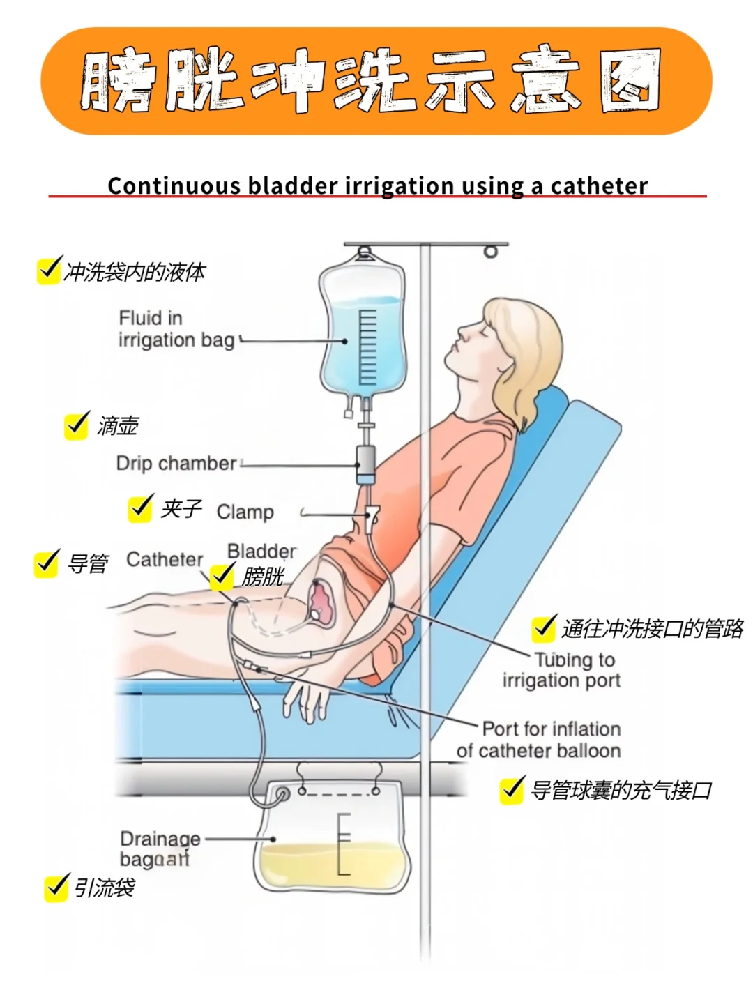 备考RN/膀胱冲洗相关单词！！学！！内容