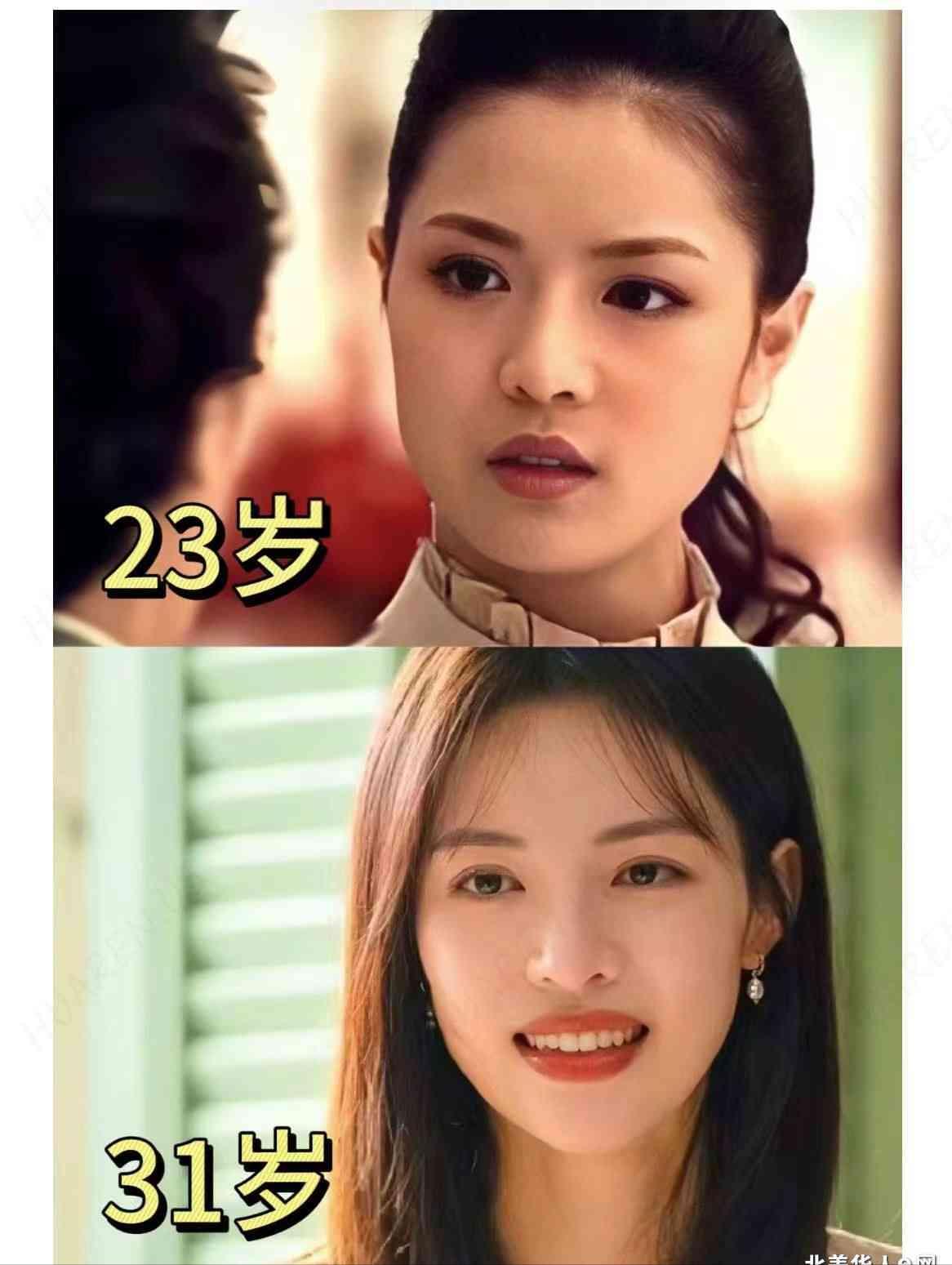 23岁和31岁的钟楚曦， 这是整容换过头了吗？其实，23岁那张好漂亮啊。