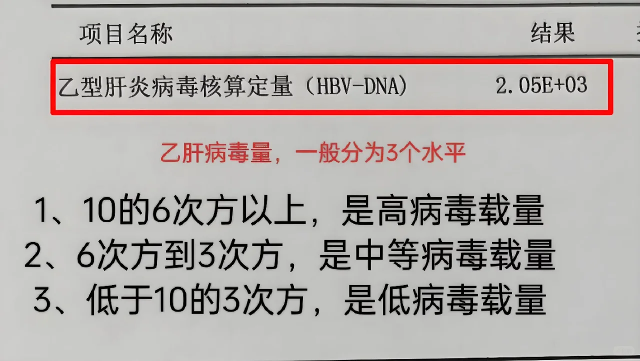 乙肝病毒量多少才算高？