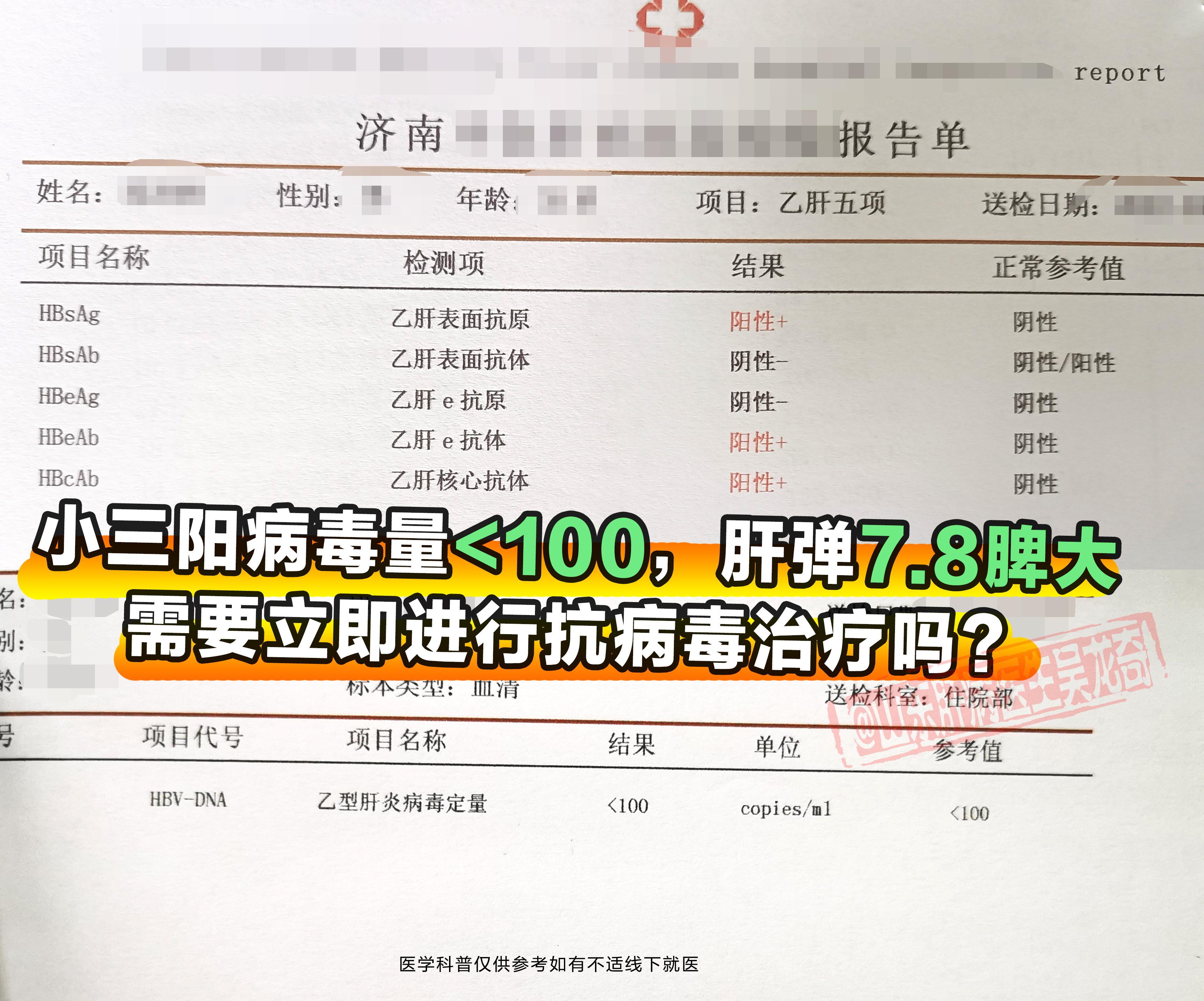 乙肝小三阳病毒量小于100，肝弹7.8kpa,伴有脾大需要立即进行抗病...