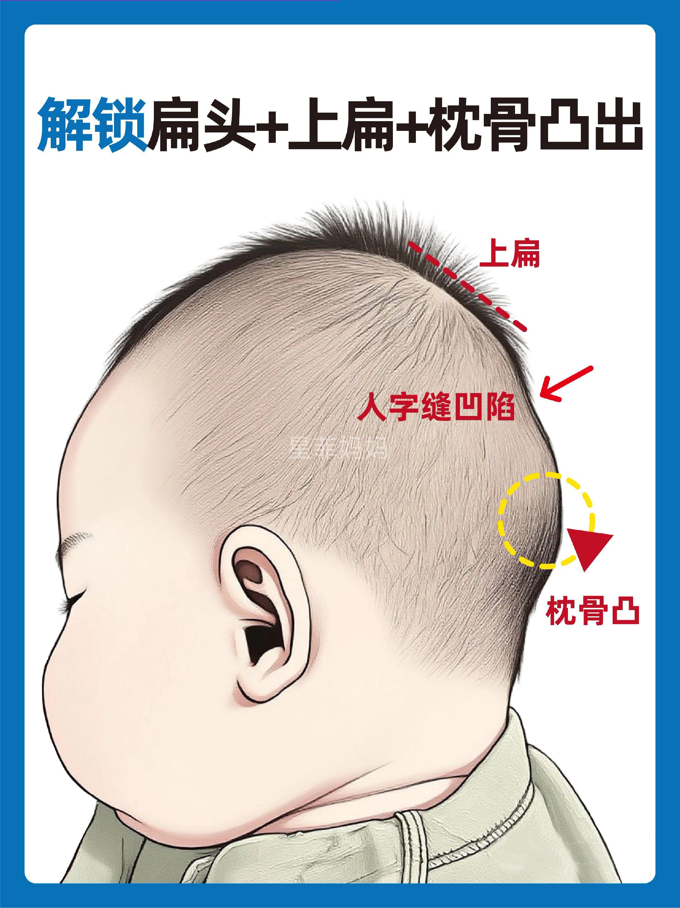 宝宝头型|全面讲清楚扁头上扁枕骨调整攻略。
