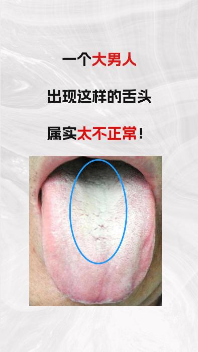 一个大男人，出现这样的舌头，太不正常了