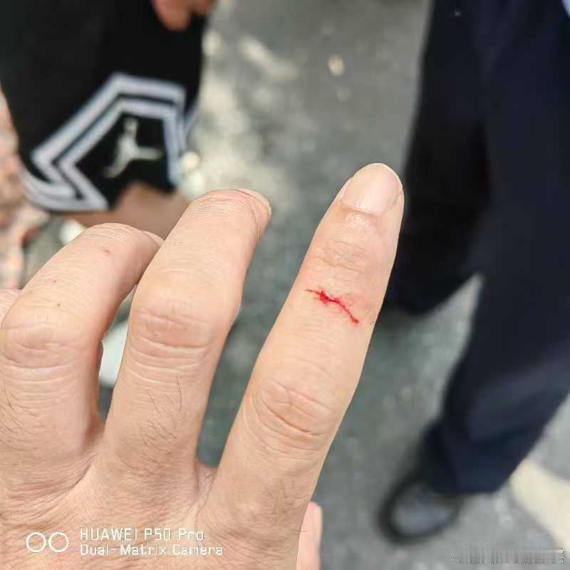 【惊险！#危急时刻巢湖这位民警徒手夺刀#】因房租问题发生纠纷，8月18日上午，一