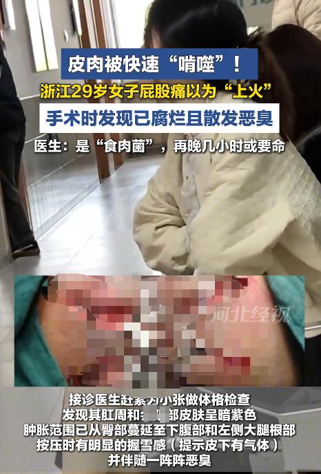 “悲剧还是发生了”！浙江杭州 29 岁的姑娘小张，就因为屁股上有点隐隐肿痛，以为