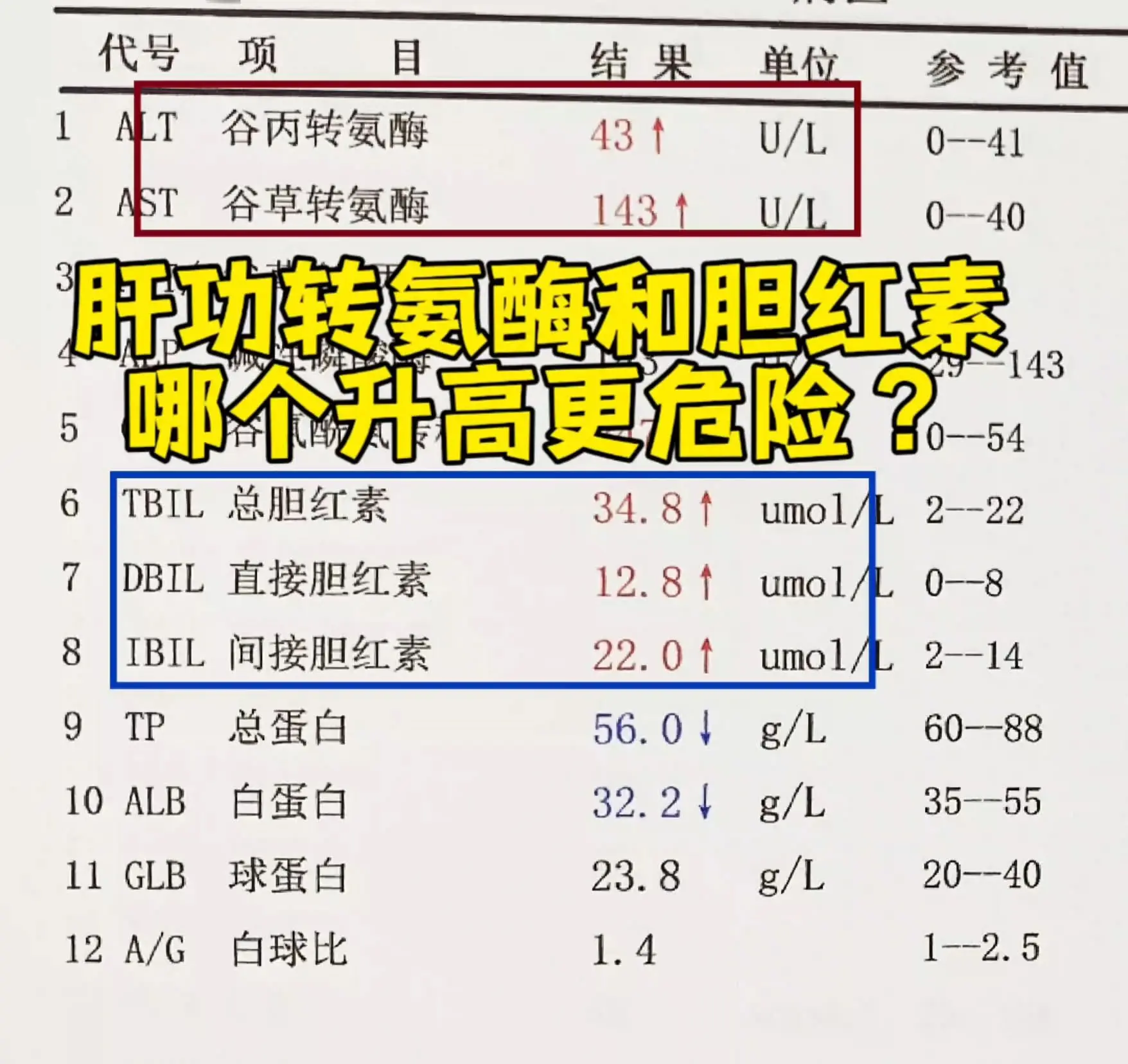 其实这两项都是肝功能报告单中非常重要的指标，但是总体而言胆红素升高要比...