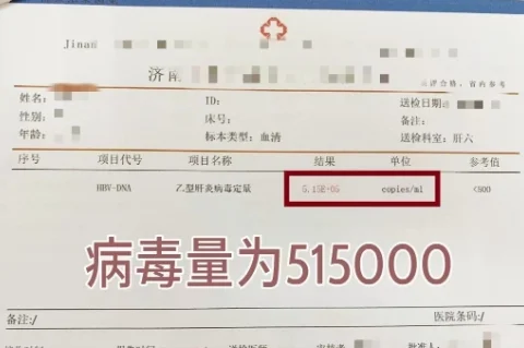 乙肝病毒量报告单，只需看懂这一点！