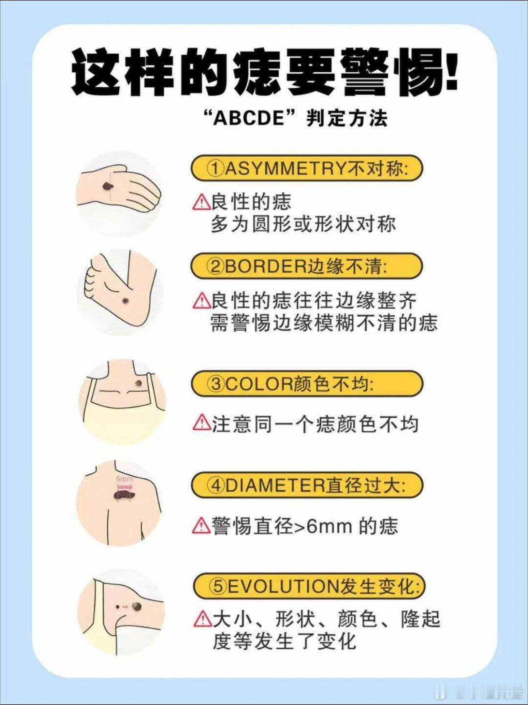 25岁女孩确诊黑色素瘤仅5个月离世想起了自己有段时间格外的关注“痣”甚至各种研究