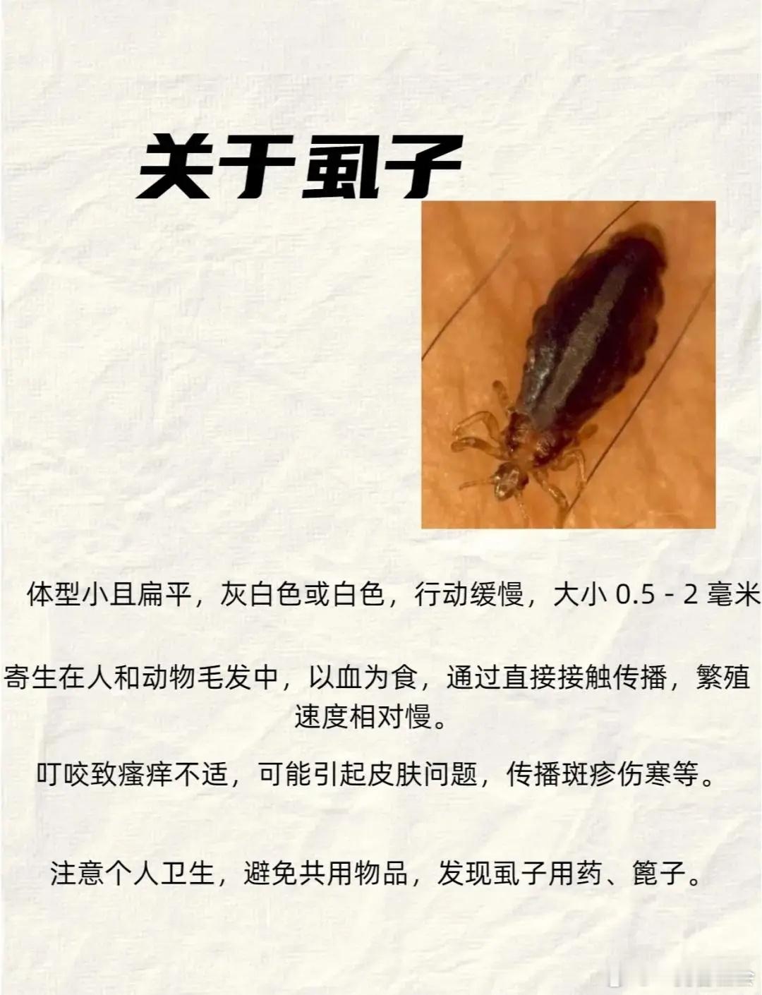 在计划经济时期，为什么人们的头上、裤袄里、被里都是虮子、虱子、跳蚤？改革开放、市