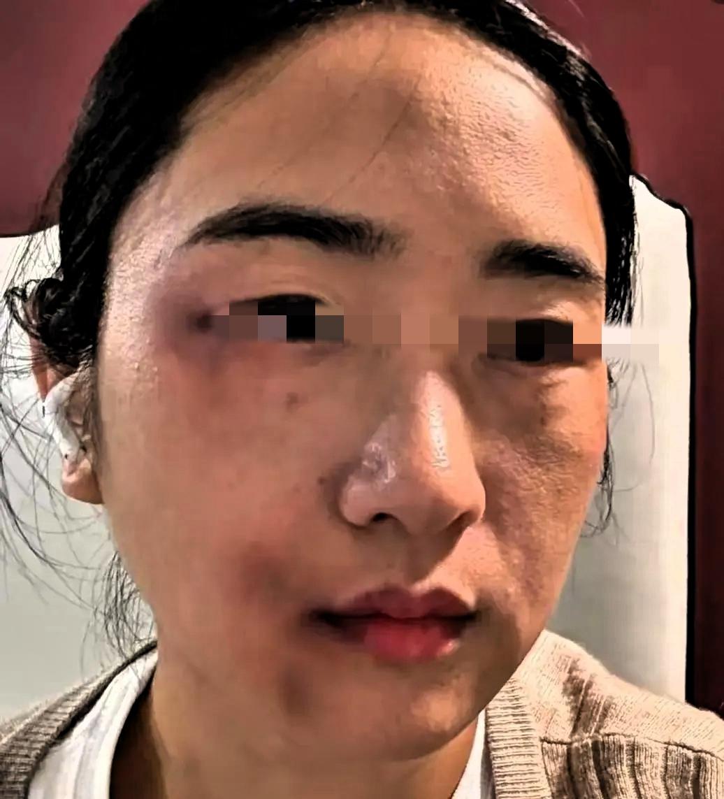 36周的准妈妈被丈夫一脚踹在腰侧，没哭没闹，转头去医院开了病历直奔派出所。她说，