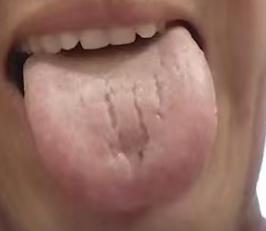 气血瘀滞无法充盈宗筋，分享活血养血疏通脉络的调理思路







对于这种顽固