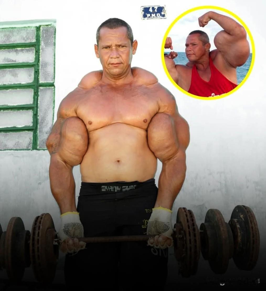 阿林多·德·索萨（Arlindo de Souza），被称为“巴西大力水手”，是