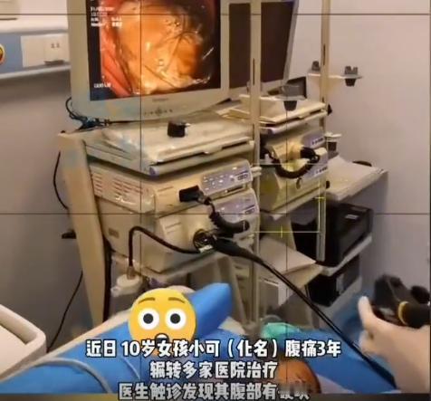 “活久见！”2025年9月，福建，一10岁女孩腹痛3年，到医院一查，竟然发现她的