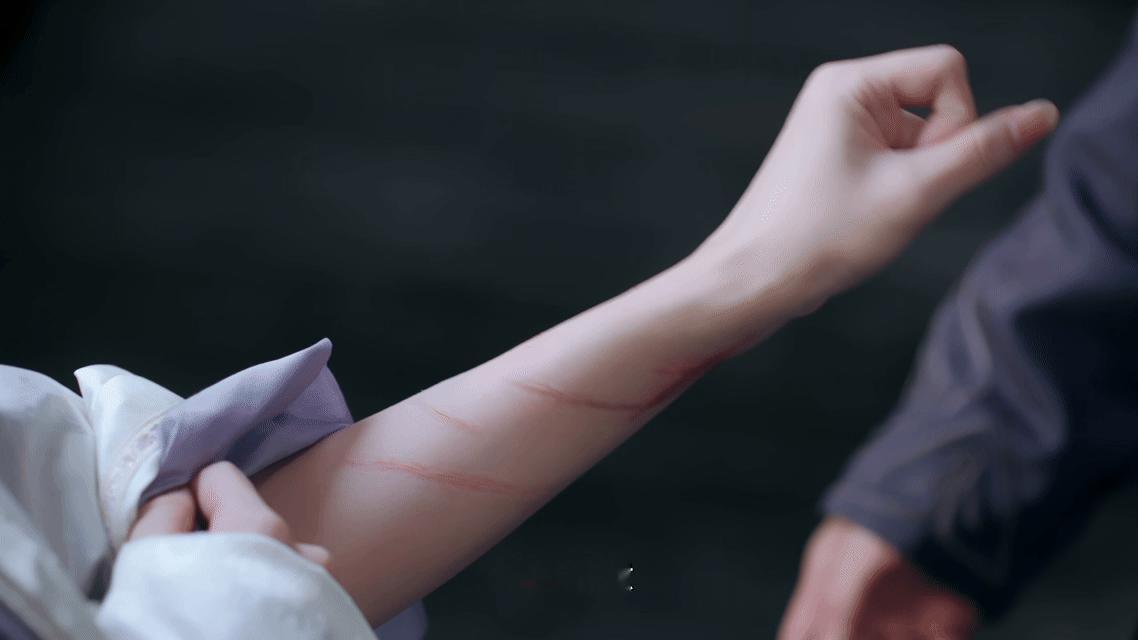 杜听馨臂上伤痕未褪，眼底媚色已藏刀，笑盈盈激陆琦沉沦，以伤为饵、以情为刃，又美又