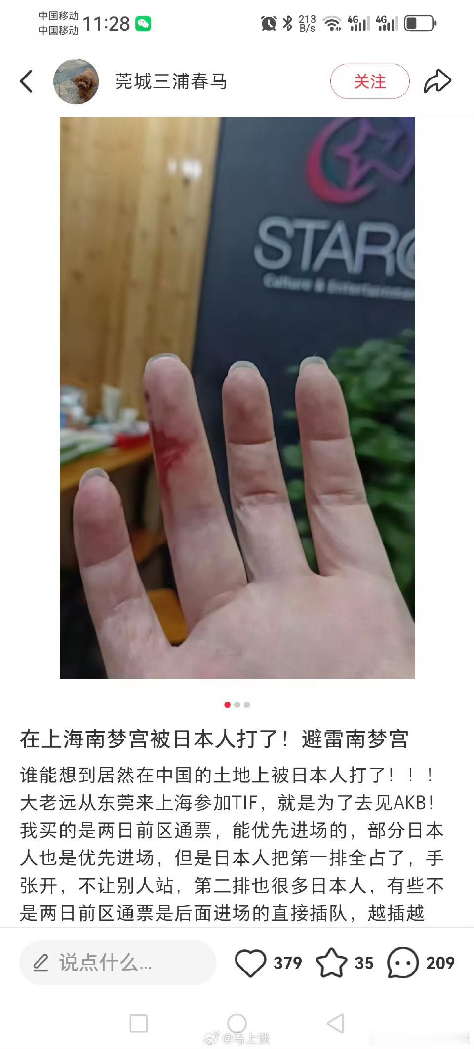 男子在上海被日本人殴打啥？在自己家被外国人打？被打了不去派出所调解，现场调解吗？
