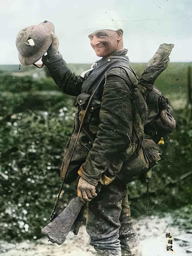 1918年，一位头部中弹，但是却被钢盔幸运挡住致命一击的士兵照片，面对...
