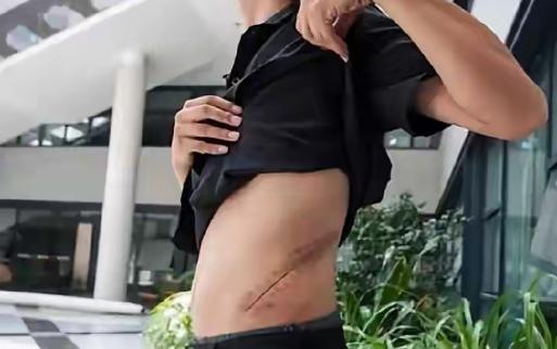 17岁的少年，噶腰子换手机，这是他的错吗？

不要问这个孩子是否后悔，15年前，
