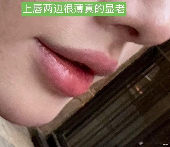 昨天又去打了水光同时给自己嘴巴也打了水光天老爷，让我执念的红唇内卷终于解决了我之