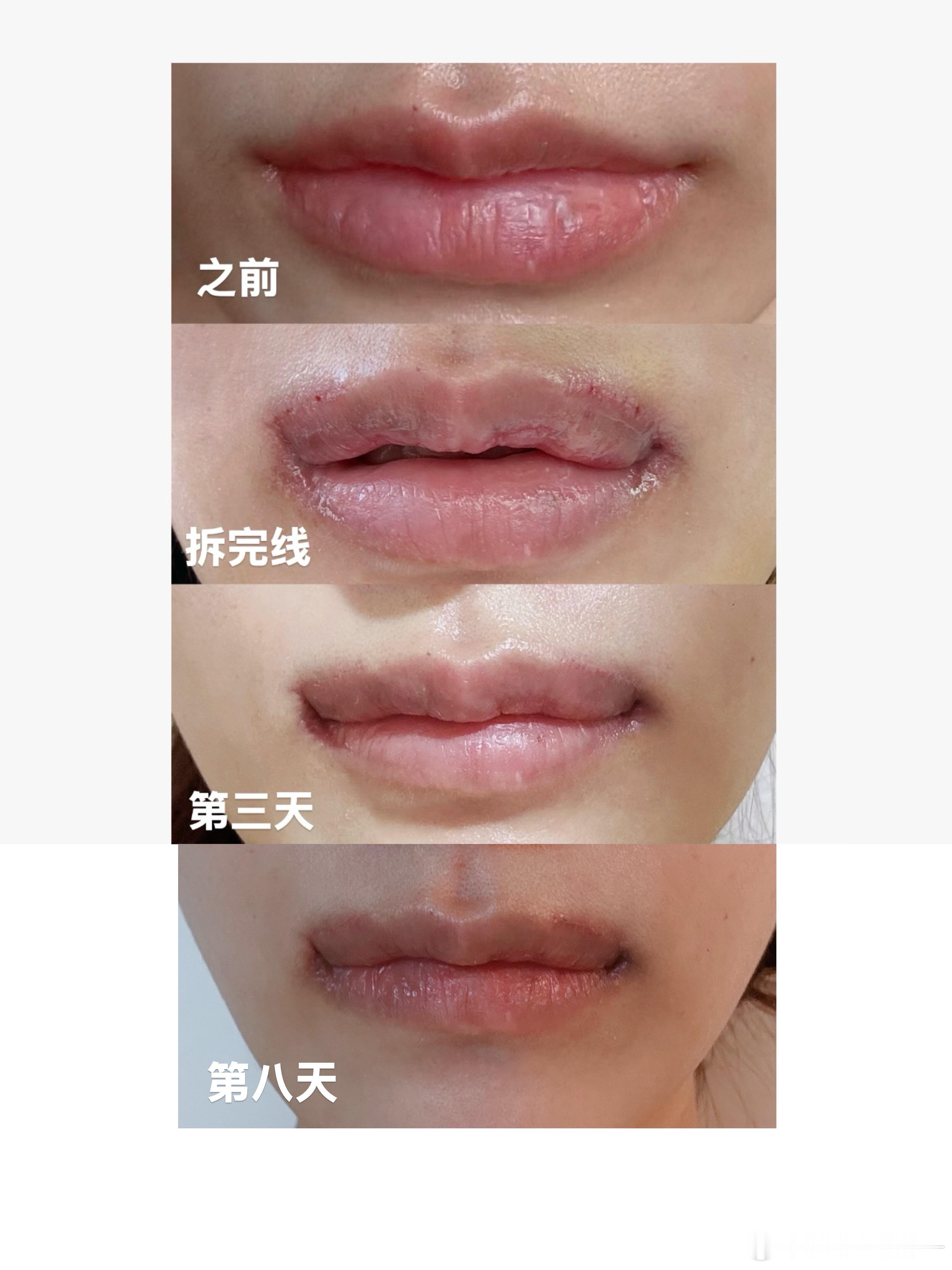 这是毁容手术吧…[惊恐] ​​​