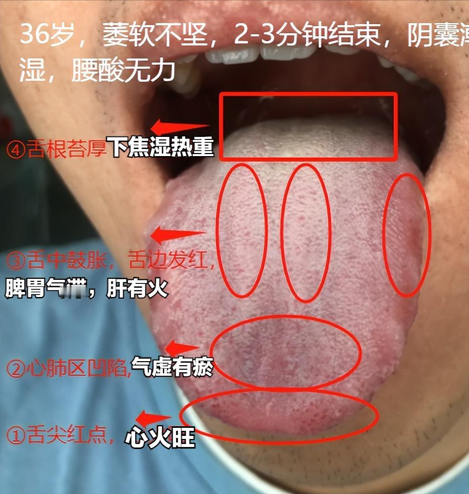 十月份挑战舌诊，第3天！每天都会抽出时间，回复！

拍摄舌诊要求：
1.不要用美