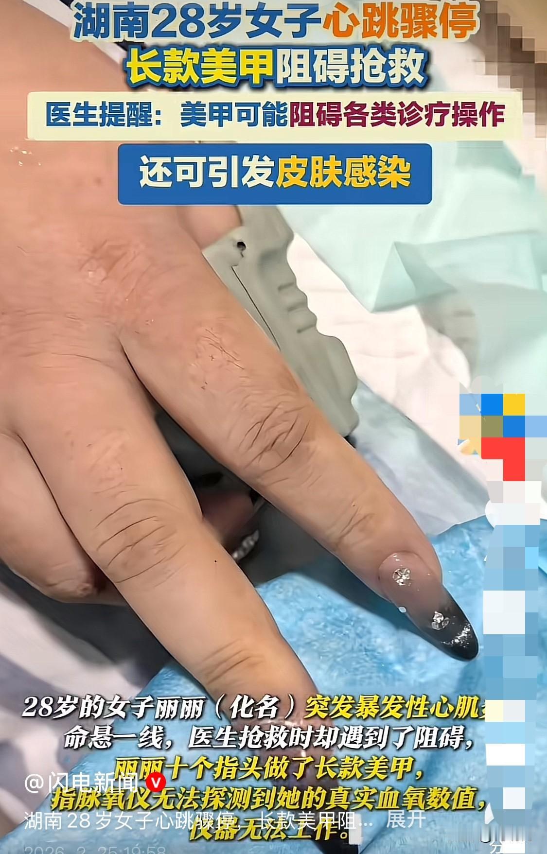 命悬一线，美甲却影响抢救！湖南一名28岁的女子，心脏骤停，医生在枪口的时候却遇到