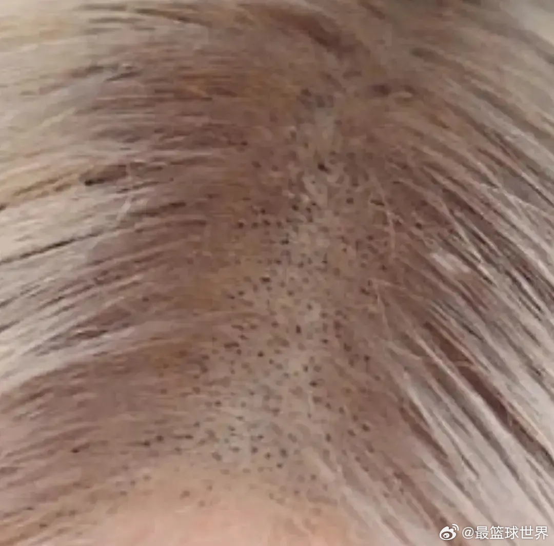 朴彩英出道至今坚持连续7年， 每两周漂白一次发根 