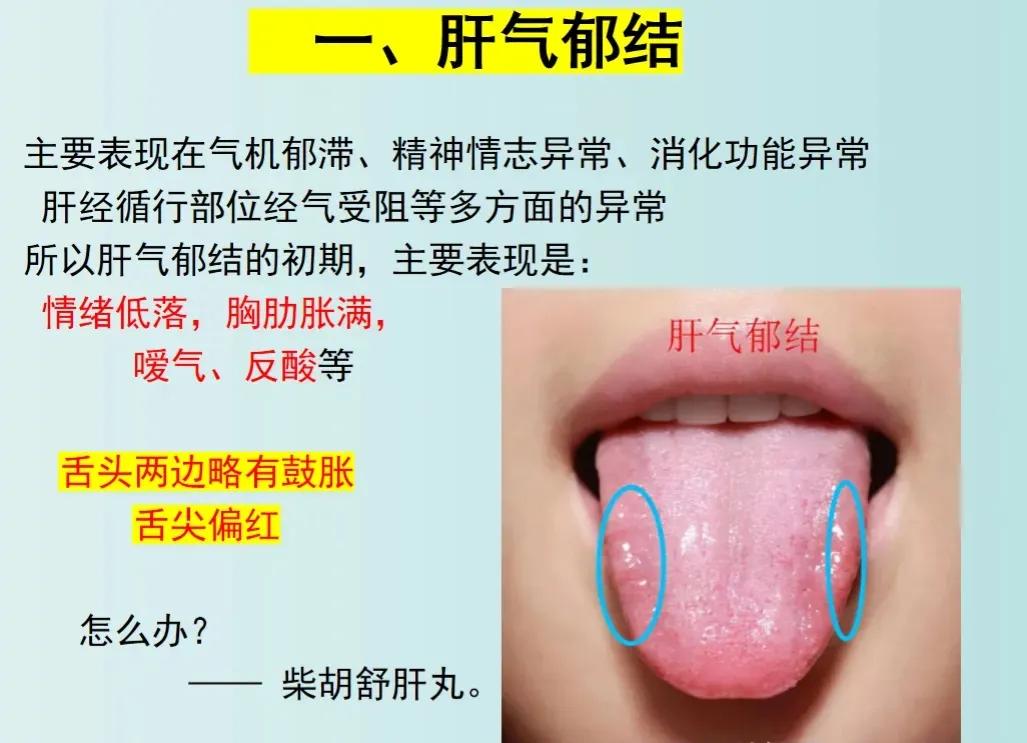压力大、爱生气，身上又长了囊肿或息肉？这可能是肝气郁结的表现！今天就来聊聊肝气郁
