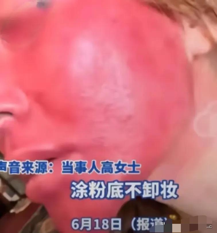 这也太吓人啦！！！！
吉林37岁女子从15岁开始化妆，就没有卸过妆。好不容易勤奋