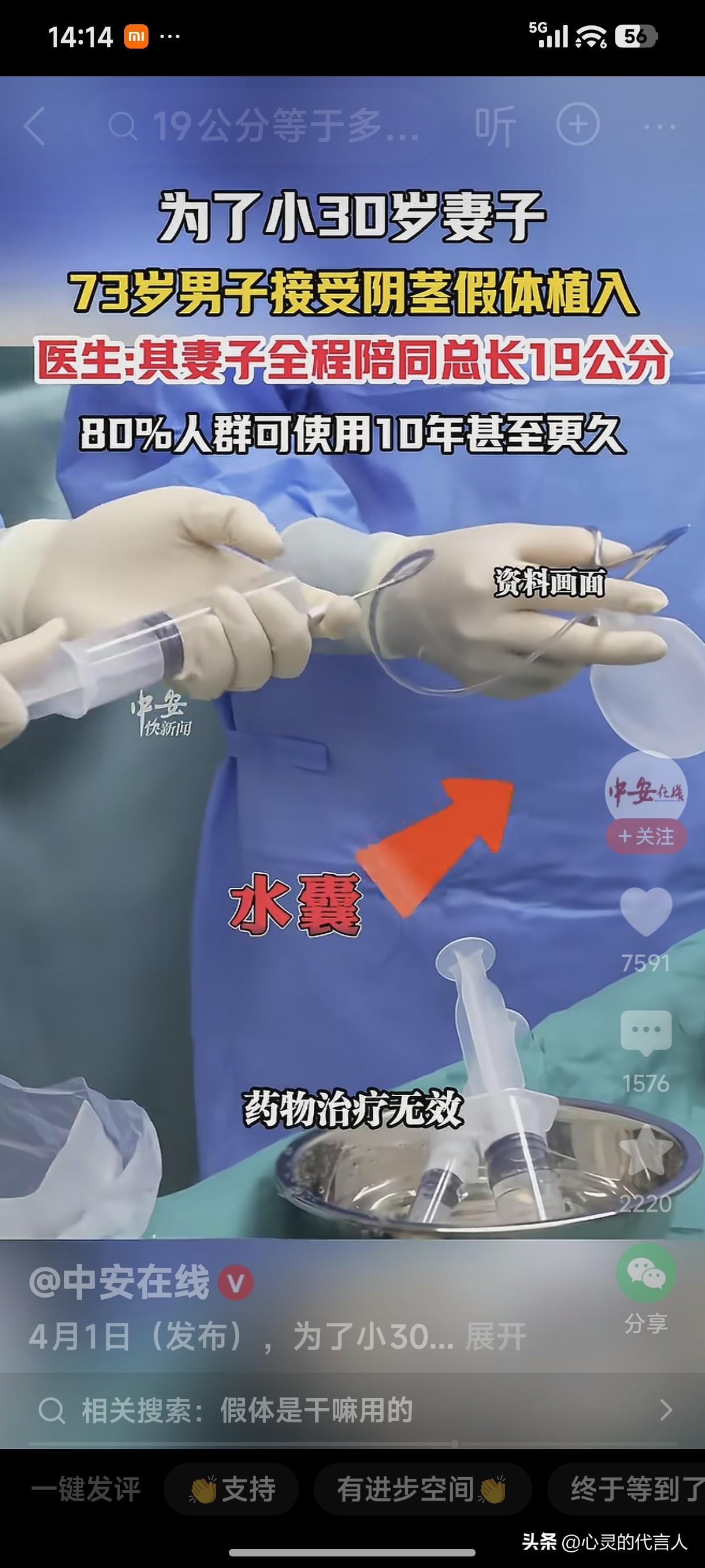 为了小30岁的妻子的幸福生活，73岁的老公接受阴茎假体植入。
医生:其妻子全程陪